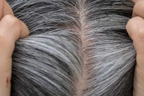 Gros plan sur des cheveux gris et blancs, montrant la décoloration naturelle. Des mains touchent délicatement la chevelure.