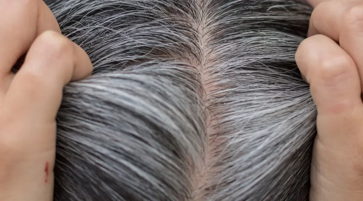 Gros plan sur des cheveux gris et blancs, montrant la décoloration naturelle. Des mains touchent délicatement la chevelure.