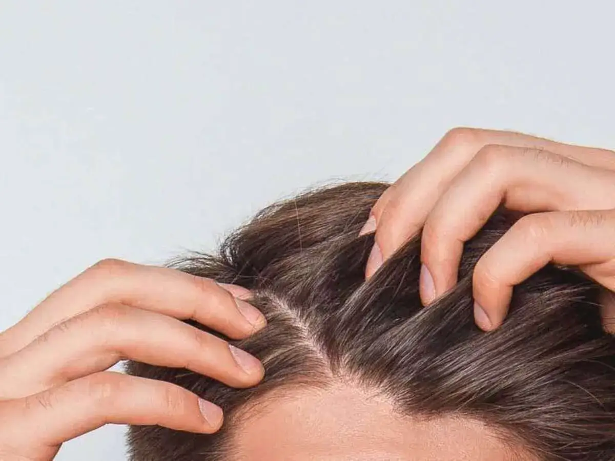 Mains grattant le cuir chevelu, peut-être à cause d'un vinaigre cheveux danger.
